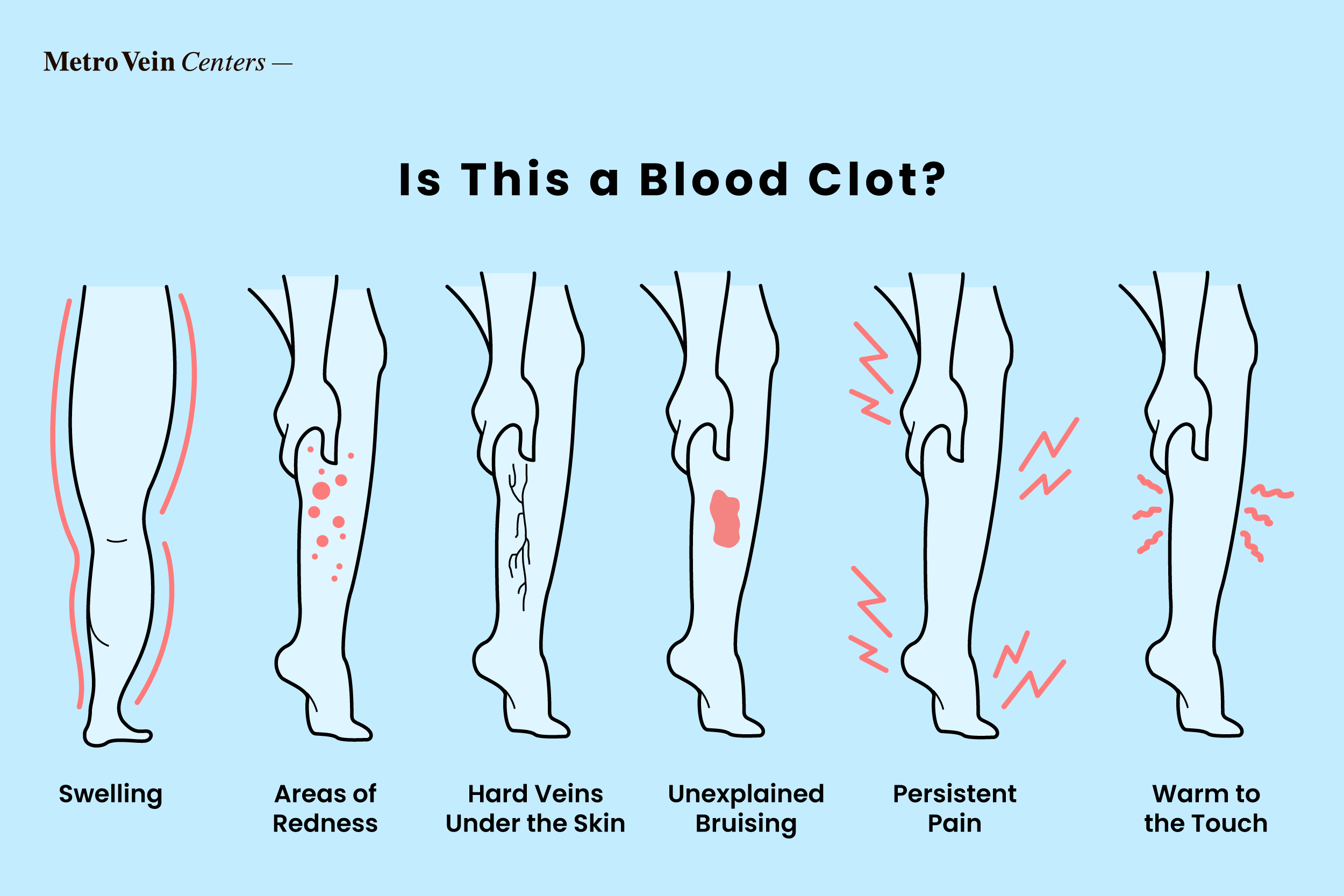 Learn how to identify blood clots in your ankles, feet, and legs with detailed pictures. Discover symptoms, diagnosis, and treatment options for safer legs.