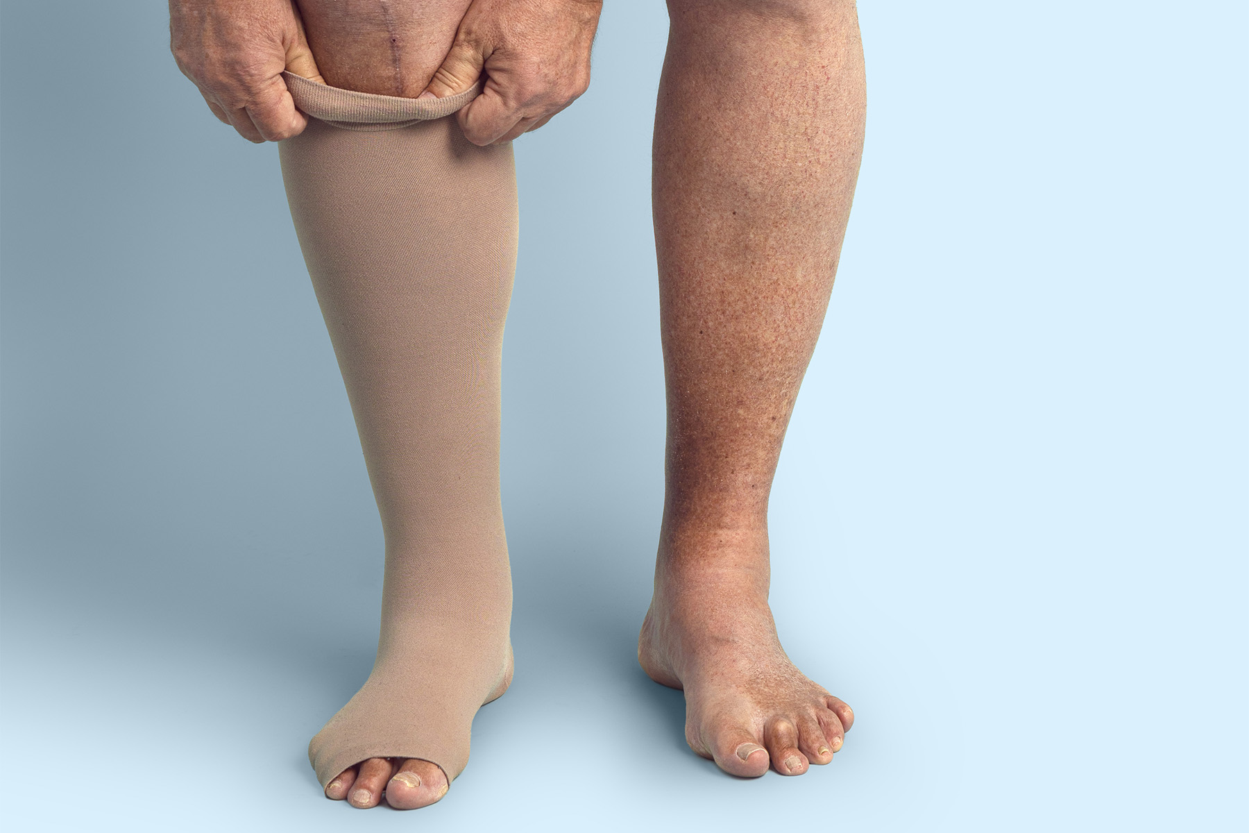 Vein health supports circulation, energy, and mobility. Prevent varicose veins, CVI, leg swelling, and heaviness with simple wellness habits.