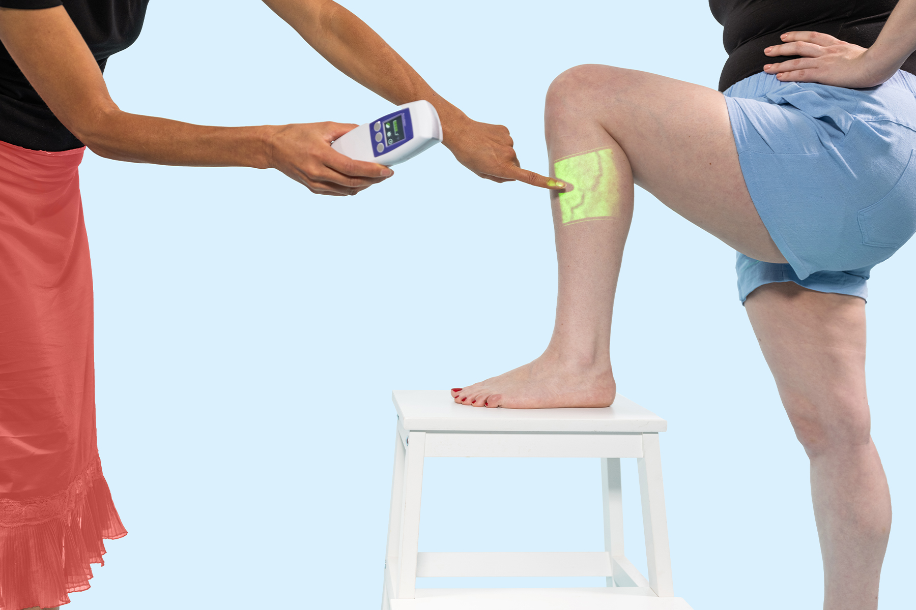 Aprende a identificar co&aacute;gulos de sangre en los tobillos, pies y piernas con im&aacute;genes detalladas. Descubre los s&iacute;ntomas, el diagn&oacute;stico y las opciones de tratamiento para unas piernas m&aacute;s seguras.