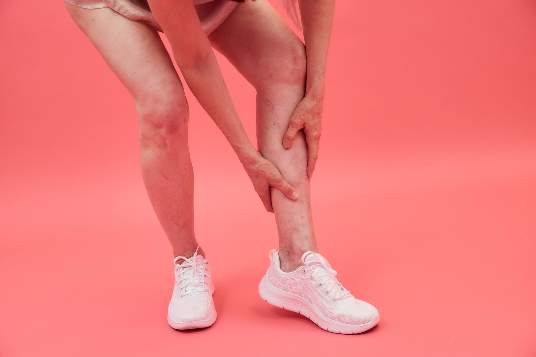 leg swelling from heat edema on an active adult